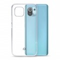 Xiaomi MI 11/11PRO silicone case transparent Batteries for phones, video cameras cases protecting glasses and other parts